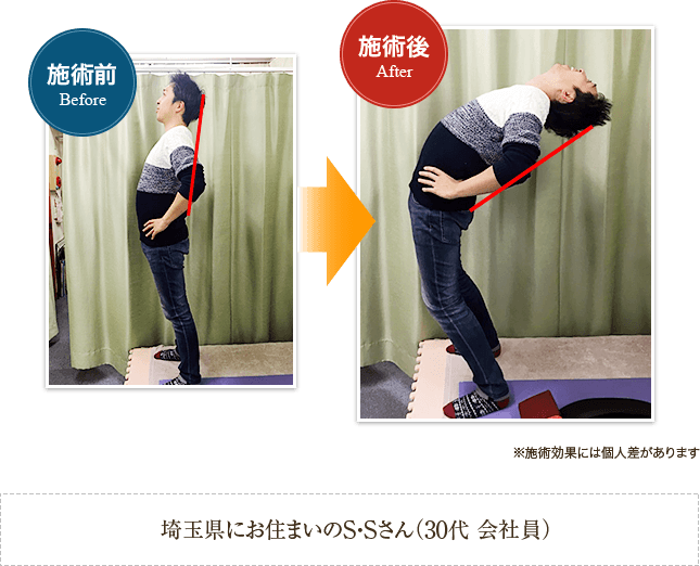 施術前後の変化 before after