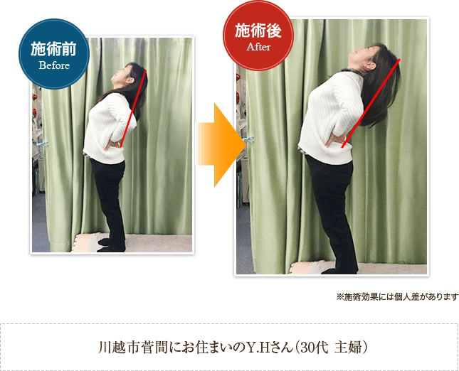 施術前後の変化 before after